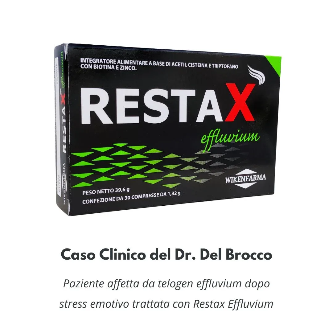 telogen effluvium stress