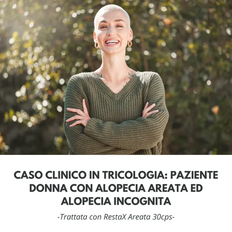 caso clinico alopecia areata