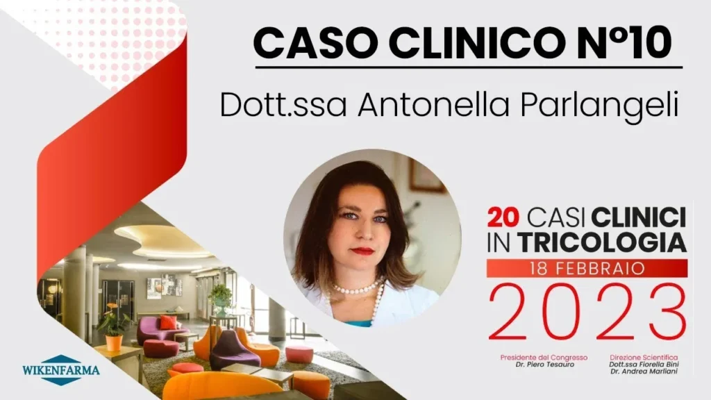 20 casi clinici in tricologia