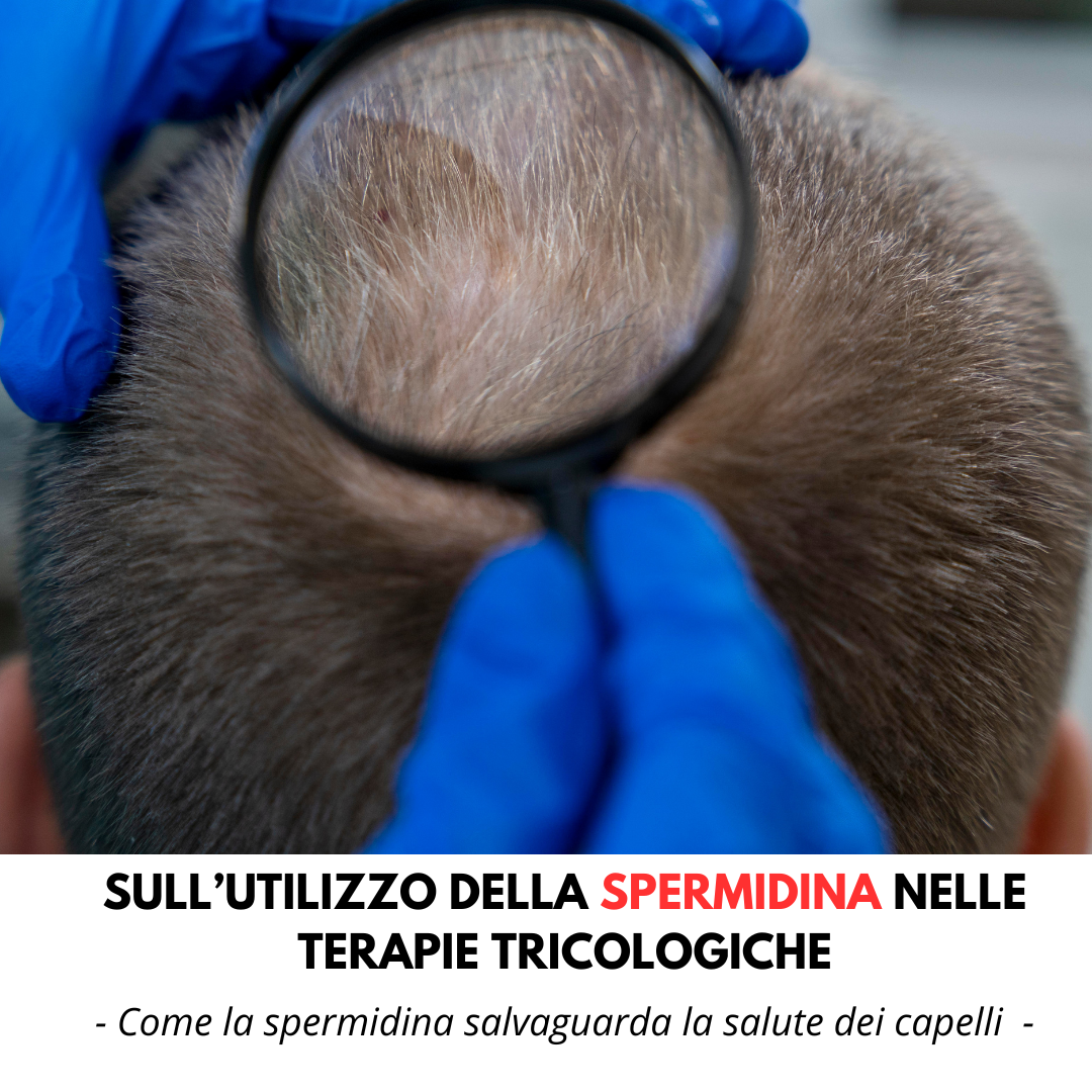 spermidina tricologia effluvio