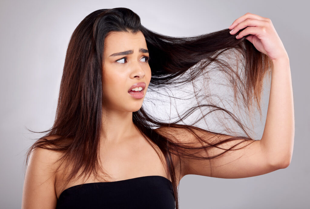 alopecia femminile